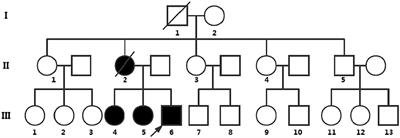 Identification and Clinical Analysis of the First Nonsense Mutation in the PSEN1 Gene in a Family With Acute Encephalopathy and Retinitis Pigmentosa